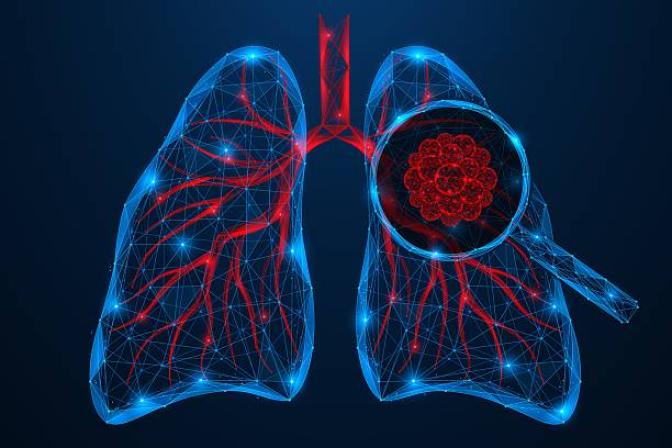Ecoute ton souffle - Stand d'info, de sensibilisation et d'évaluation en santé respiratoire - Hôpital Universitaire de Bruxelles
