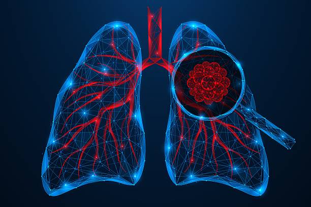 Ecoute ton souffle - Stand d'info, de sensibilisation et d'évaluation en santé respiratoire - Hôpital Universitaire de Bruxelles