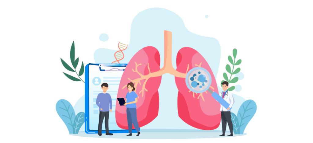 Oncologie thoracique