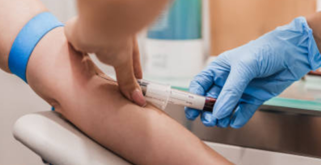 Comprendre le lupus - Diagnostic - prise de sang - Hôpital Erasme - H.U.B