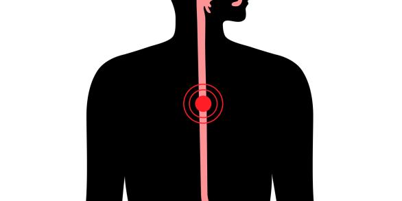 oesophage