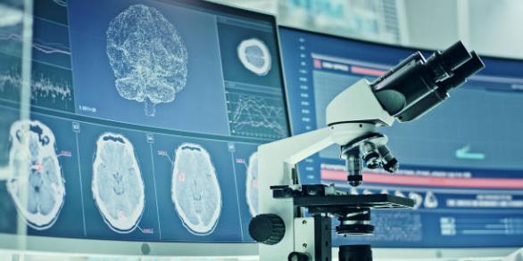 Scan cerveau et microscope