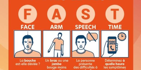 Reconnaître les signes d'un AVC - FAST test - Hôpital Universitaire de Bruxelles