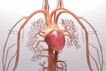 Hypertension pulmonaire illustration