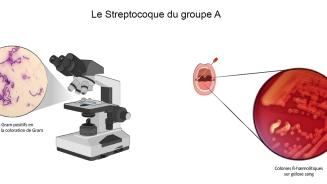recherche_strepto.jpg