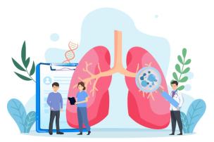 Oncologie thoracique